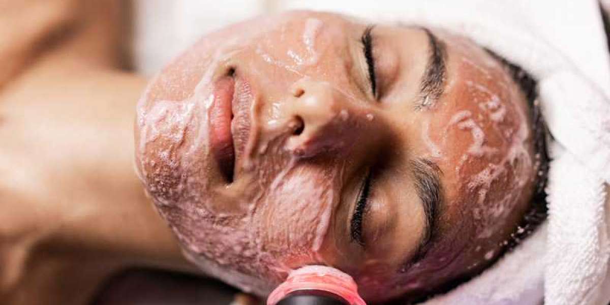 Get the Best Hyperpigmentation Treatment at Revive Beauty Solutions