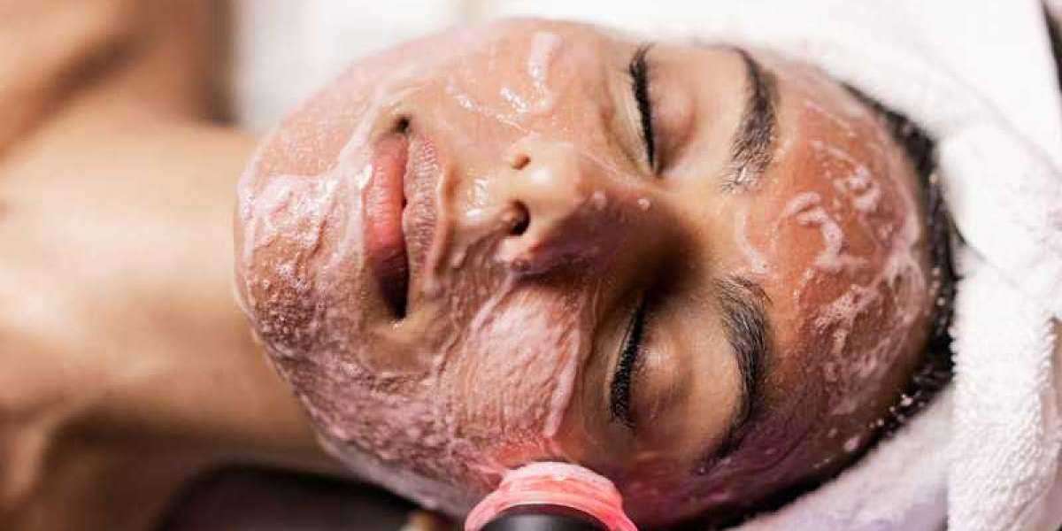 Get the Super OxyGeneo Facial Treatment at Revive Beauty Solutions